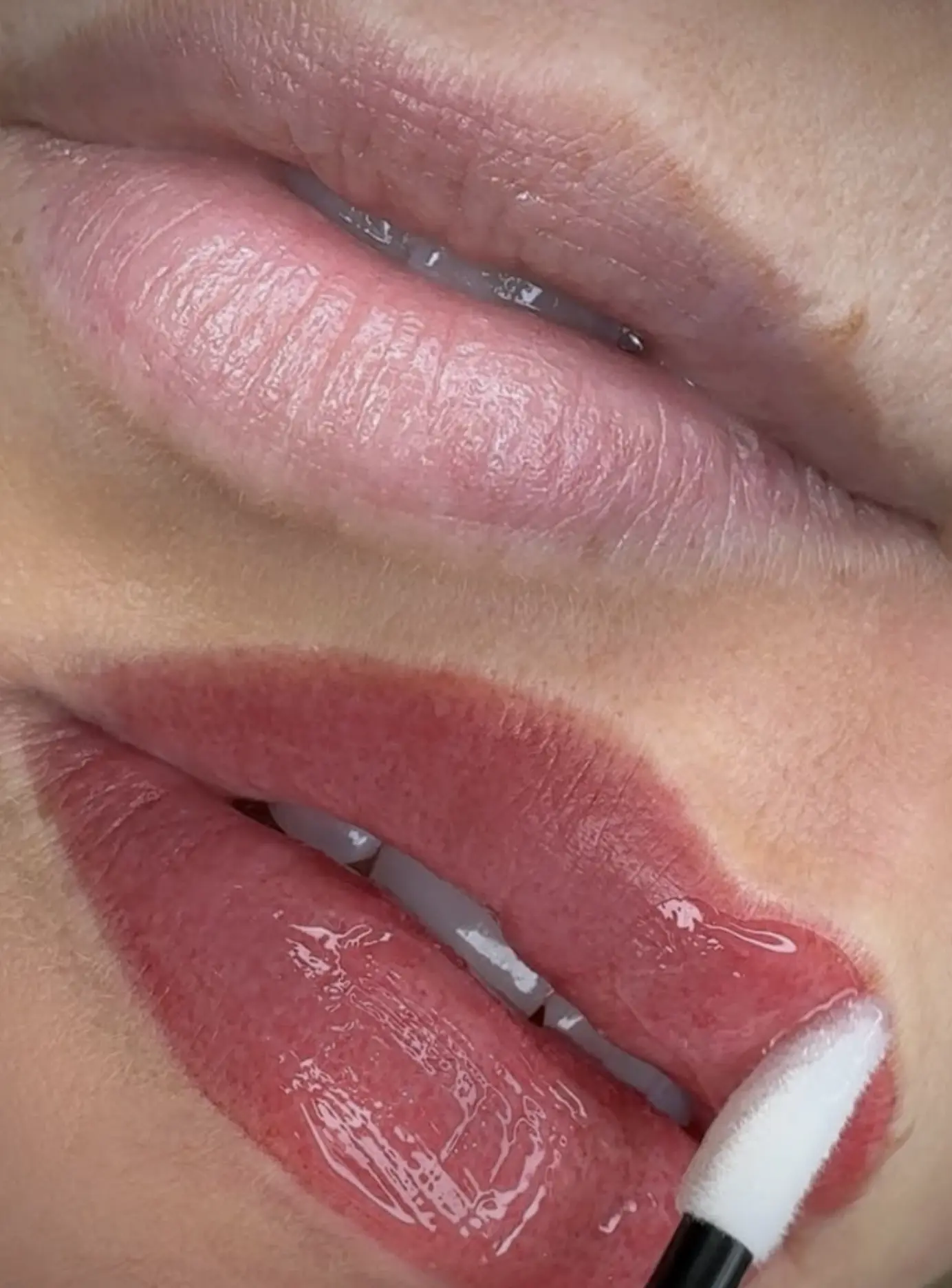 What Should I Put on My Lips After Lip Blushing?